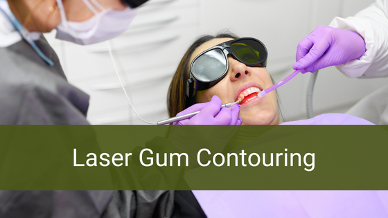 Laser Gum Contouring
