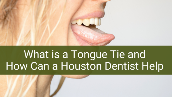 What is a Tongue Tie and How Can a Houston Dentist Help