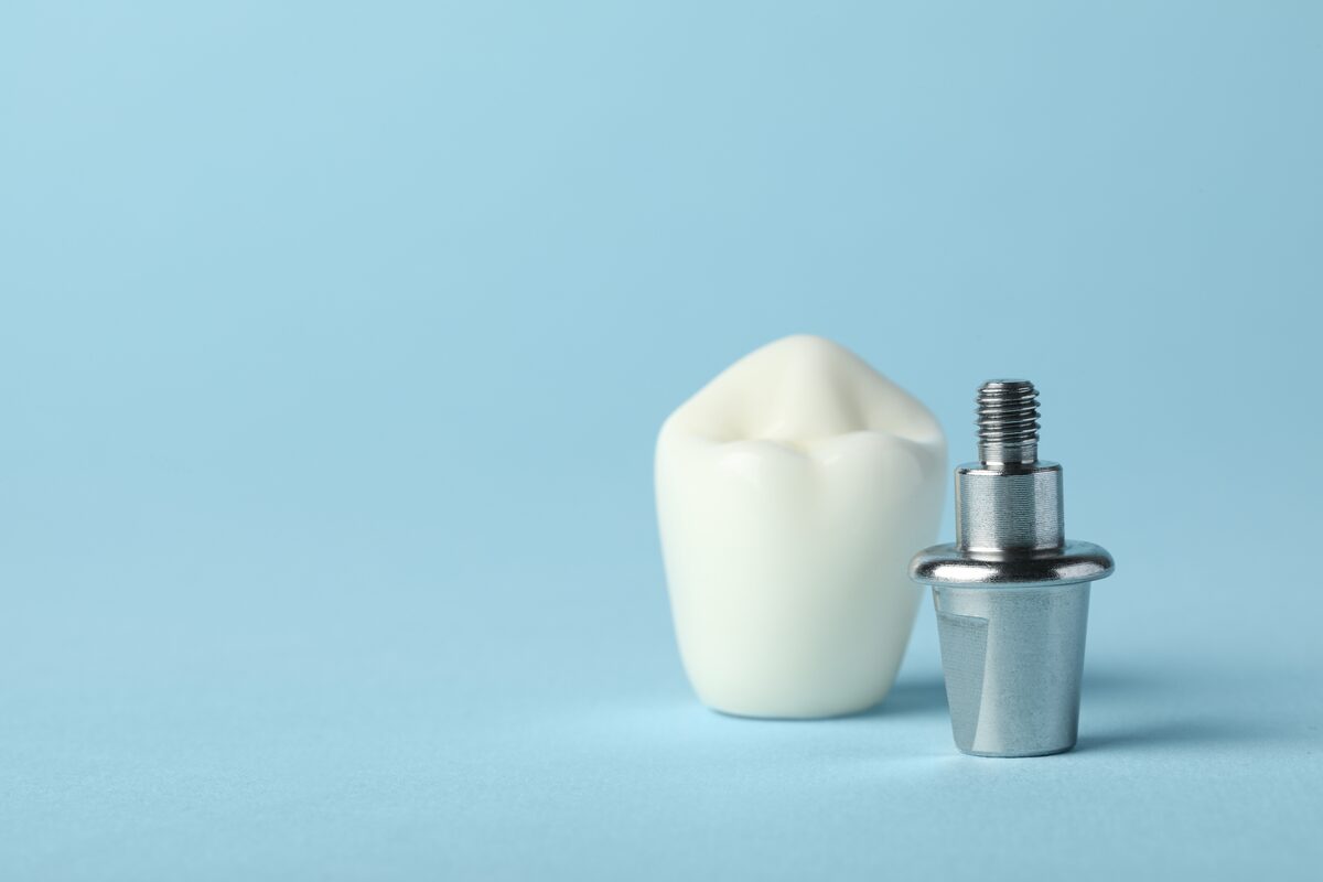 A dental implant abutment and the prosthetic crown that fits over it, shown side by side