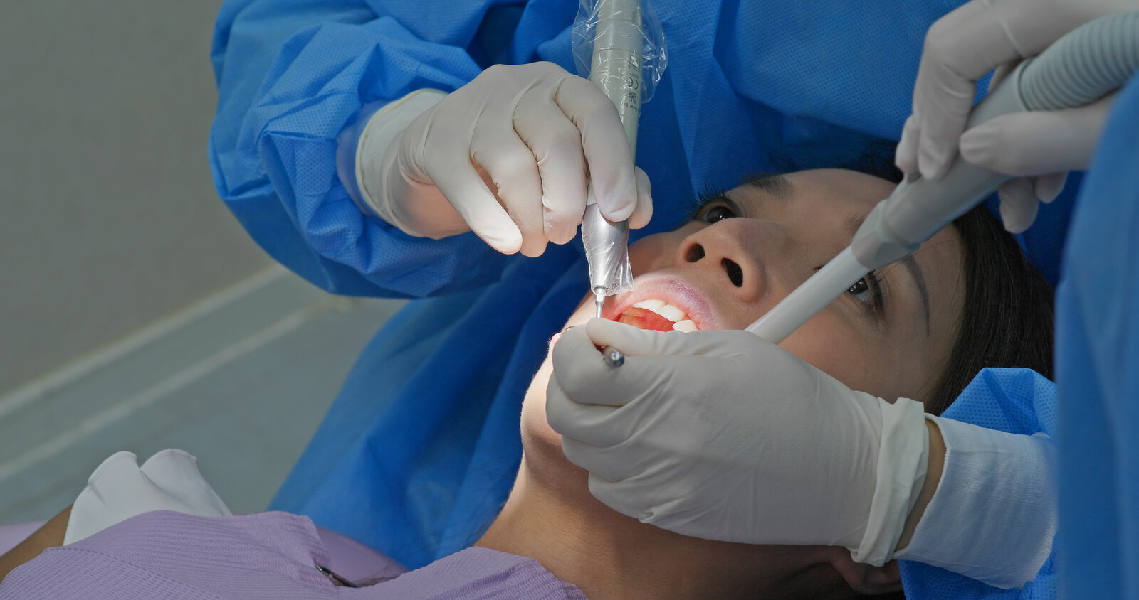 Dental team performing scaling and root planing below a patient’s gum line